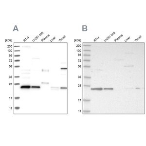 Merck Anti-VPS28 antibody produced in rabbit
