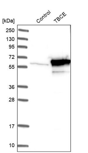 Merck Anti-TBCE antibody produced in rabbit