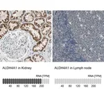 Merck Anti-ALDH4A1 antibody produced in rabbit
