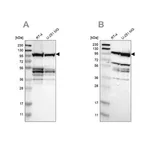 Merck Anti-EIF4G2 antibody produced in rabbit