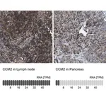Merck Anti-CCM2 antibody produced in rabbit