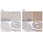 Merck Anti-ATXN2 antibody produced in rabbit