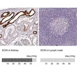 Merck Anti-SCIN antibody produced in rabbit