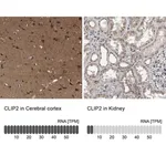 Merck Anti-CLIP2 antibody produced in rabbit