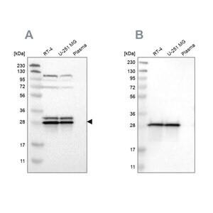 Merck Anti-ETFB antibody produced in rabbit