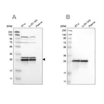 Merck Anti-ETFB antibody produced in rabbit