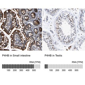 Merck Anti-P4HB antibody produced in rabbit