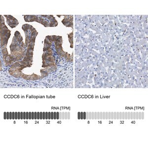 Merck Anti-CCDC6 antibody produced in rabbit