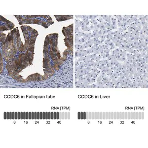 Merck Anti-CCDC6 antibody produced in rabbit