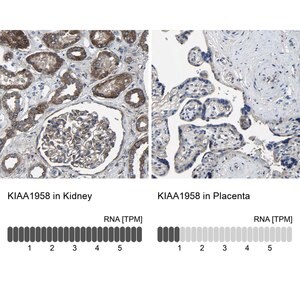 Merck Anti-KIAA1958 antibody produced in rabbit