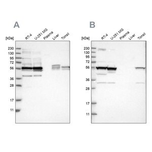 Merck Anti-SMU1 antibody produced in rabbit