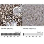 Merck Anti-HIBADH antibody produced in rabbit
