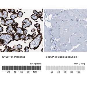 Merck Anti-S100P antibody produced in rabbit