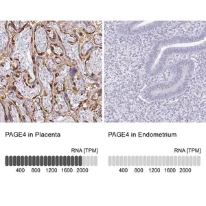 Merck Anti-PAGE4 antibody produced in rabbit
