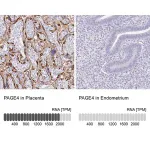 Merck Anti-PAGE4 antibody produced in rabbit