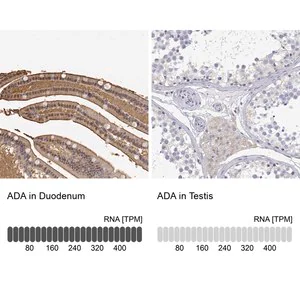 Merck Anti-ADA antibody produced in rabbit