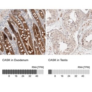 Merck Anti-CASK antibody produced in rabbit