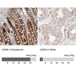 Merck Anti-CASK antibody produced in rabbit