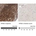 Merck Anti-NFKB2 antibody produced in rabbit