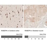 Merck Anti-RABEPK antibody produced in rabbit