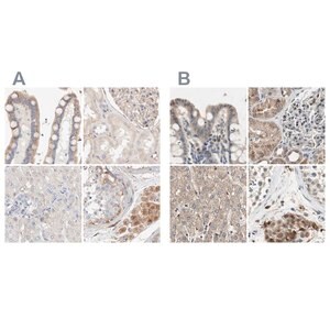 Merck Anti-PROS1 antibody produced in rabbit