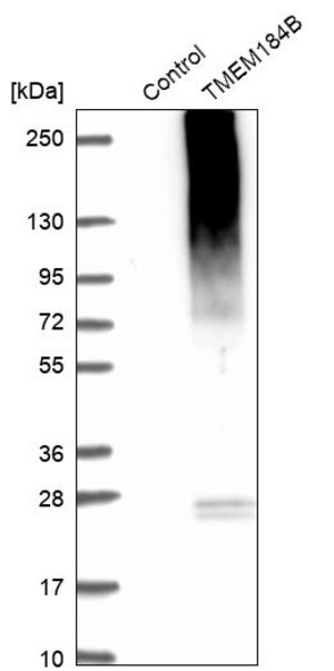 Merck Anti-TMEM184B antibody produced in rabbit