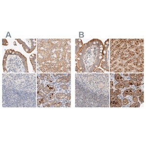 Merck Anti-HDHD3 antibody produced in rabbit