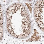 Merck Anti-HESX1 antibody produced in rabbit