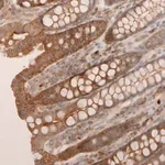 Merck Anti-VSTM2A antibody produced in rabbit