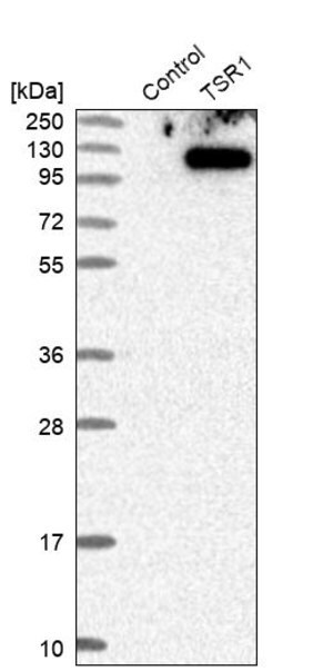 Merck Anti-TSR1 antibody produced in rabbit