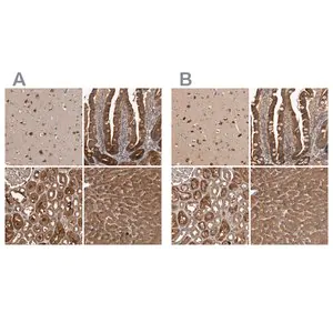 Merck Anti-TRMT61B antibody produced in rabbit