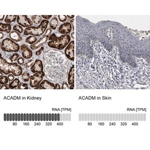 Merck Anti-ACADM antibody produced in rabbit