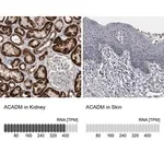 Merck Anti-ACADM antibody produced in rabbit