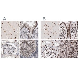 Merck Anti-RBM6 antibody produced in rabbit