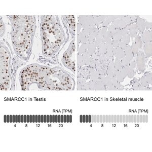 Merck Anti-SMARCC1 antibody produced in rabbit