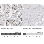Merck Anti-SMARCC1 antibody produced in rabbit