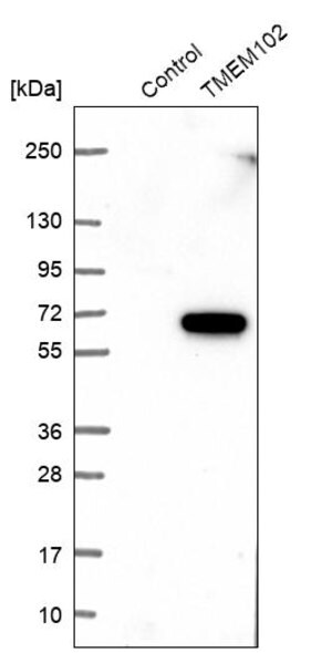 Merck Anti-TMEM102 antibody produced in rabbit