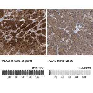 Merck Anti-ALAD antibody produced in rabbit