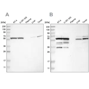 Merck Anti-CCT8 antibody produced in rabbit