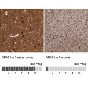 Merck Anti-VPS53 antibody produced in rabbit