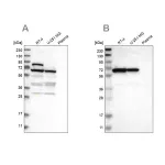 Merck Anti-NOP58 antibody produced in rabbit