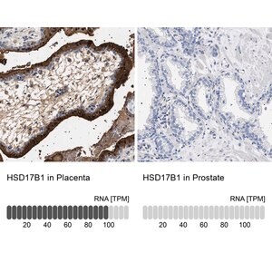 Merck Anti-HSD17B1 antibody produced in rabbit