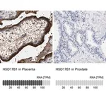 Merck Anti-HSD17B1 antibody produced in rabbit