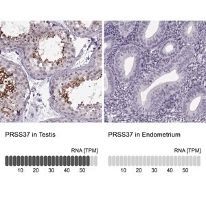 Merck Anti-PRSS37 antibody produced in rabbit