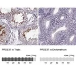 Merck Anti-PRSS37 antibody produced in rabbit