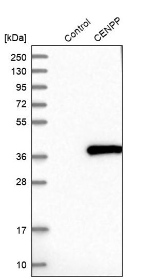 Merck Anti-CENPP antibody produced in rabbit