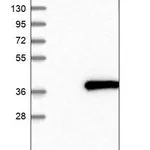 Merck Anti-CENPP antibody produced in rabbit