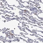 Merck Anti-SVEP1 antibody produced in rabbit