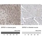 Merck Anti-ZBTB21 antibody produced in rabbit