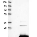 Merck Anti-SAMD12 antibody produced in rabbit
